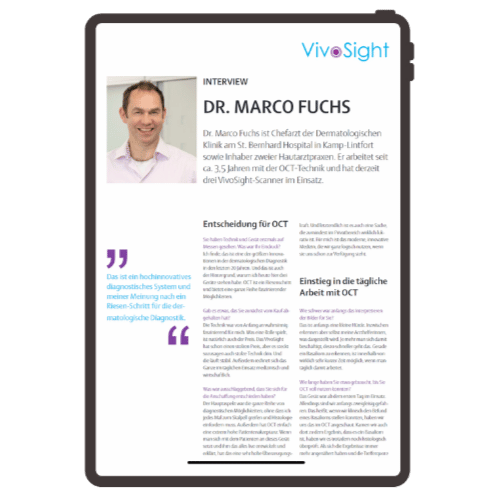 User Story VivoSight