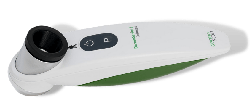 DermoGenius 3 Dermatoskop