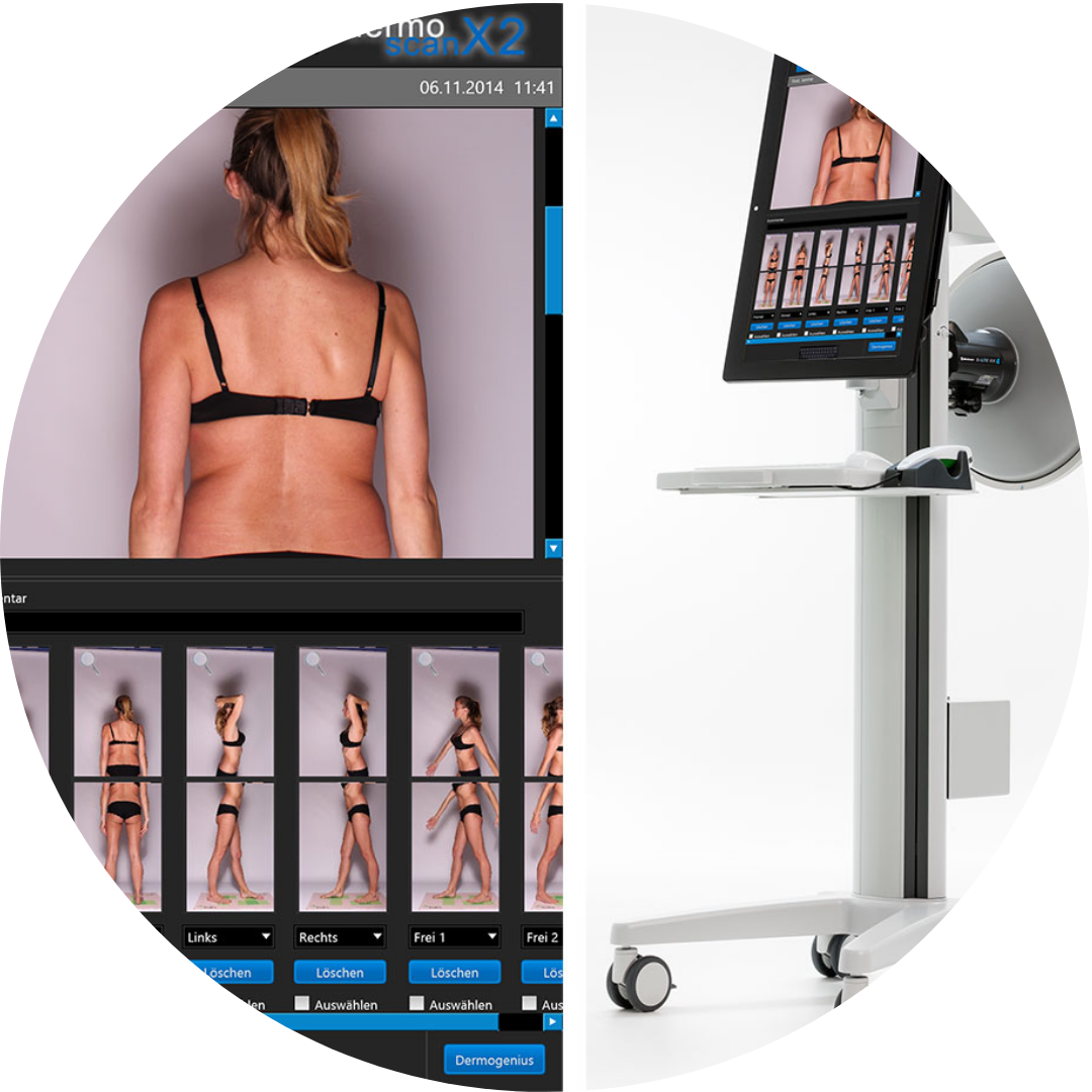 Total Body Mapping