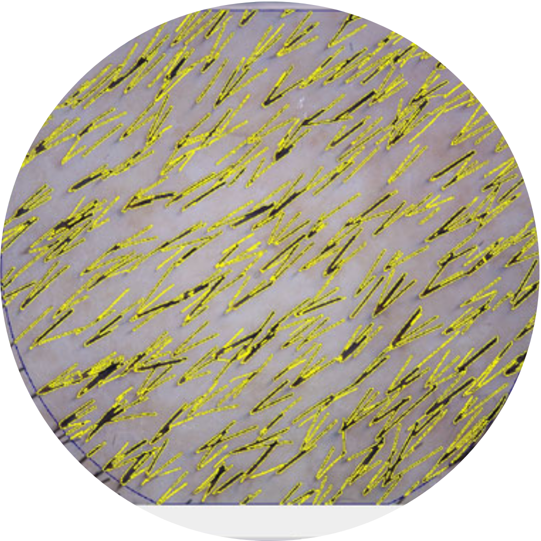 Trichoskopie          