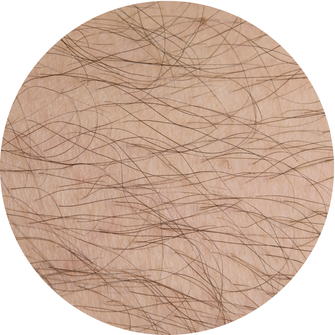 Diodenlaser