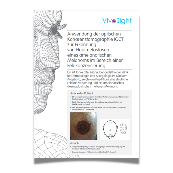 Anwendungsfälle Optische Kohärenztomographie OCT
