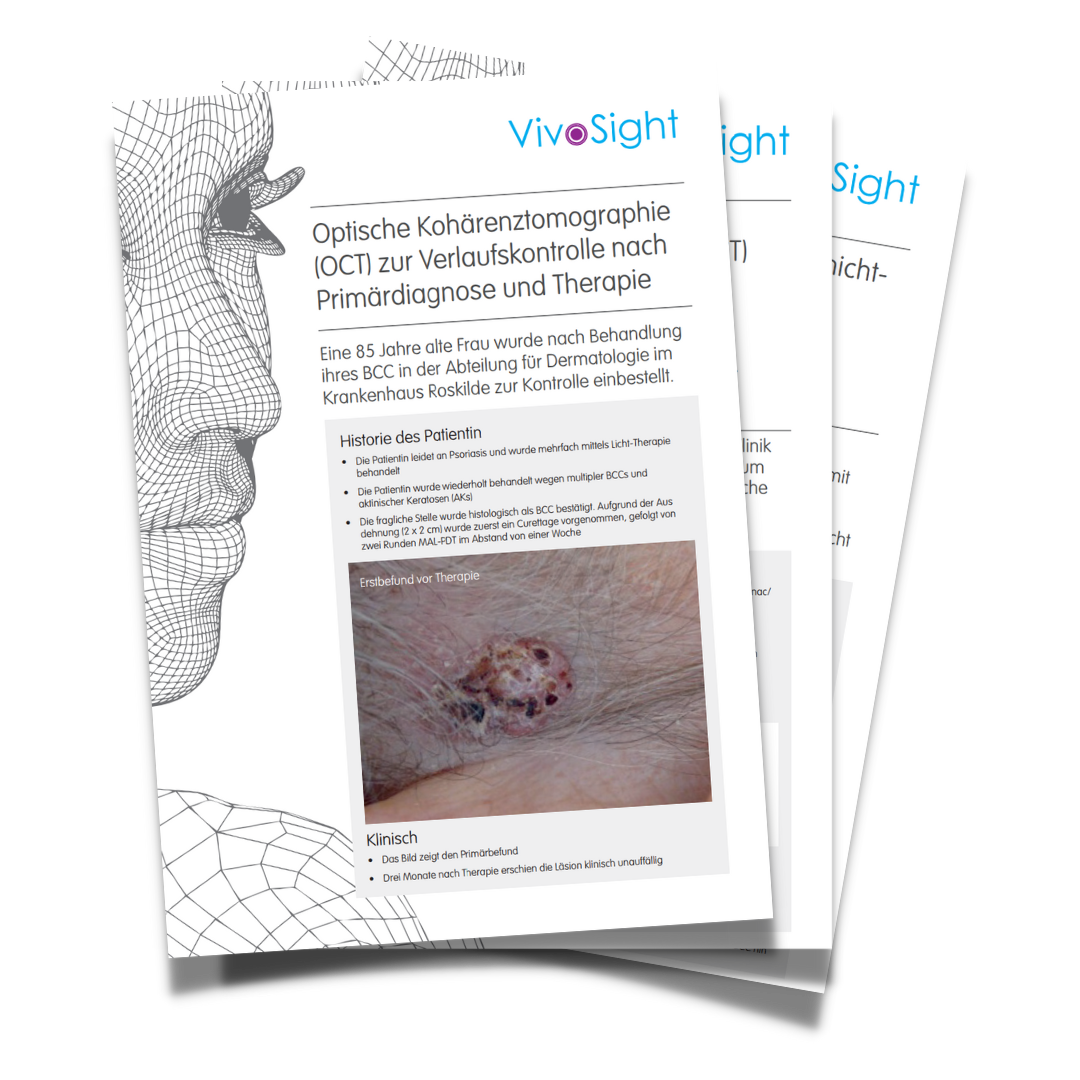 VivoSight Anwendungsfälle VivoSight Anwendungsfälle