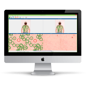 MoleExpert Macro Software