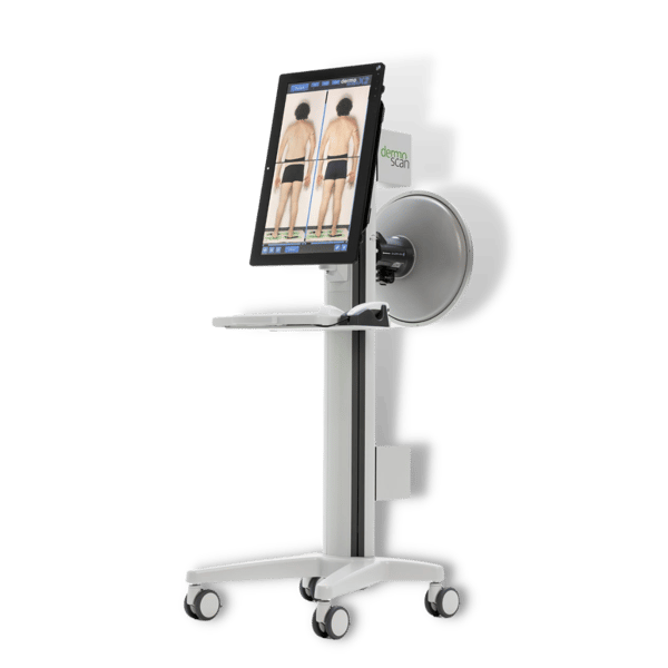 DermoScan X2 Total Body Mapping
